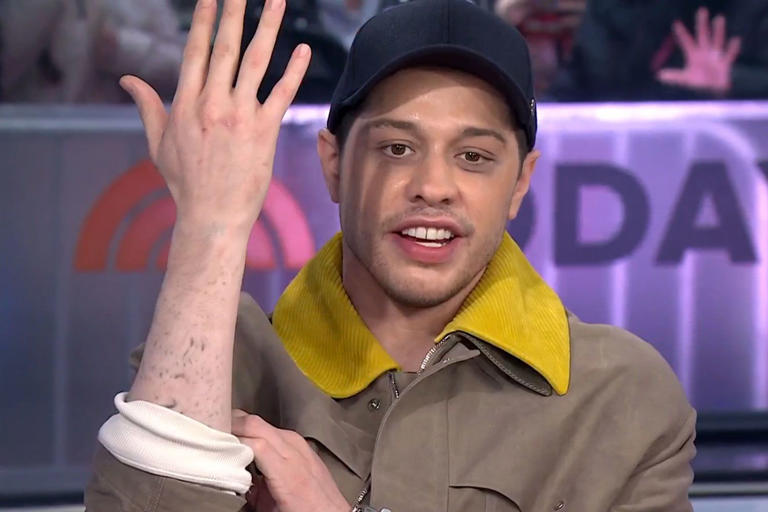 pete davidson tattoo removal